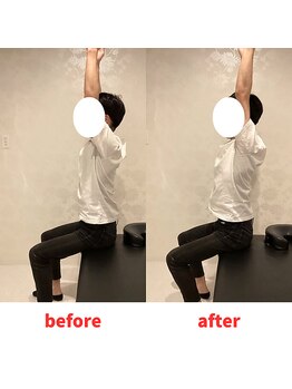 ナオル整体 福岡香椎院(NAORU整体)/20代男性施術事例【猫背】