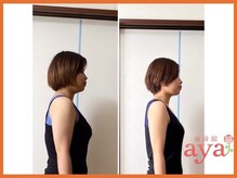 痩身館アヤ(aya)/耳つぼダイエット【富山/痩身】