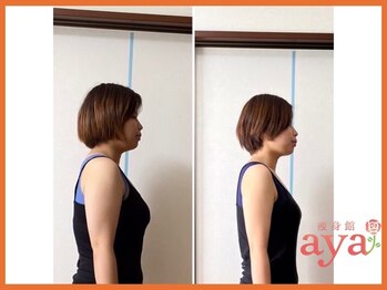 痩身館アヤ(aya)/耳つぼダイエット【富山/痩身】