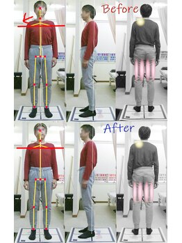 姫路なごみ整体院 なごみ鍼灸院/改善例（背中の張と肩こり