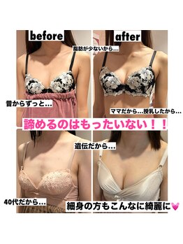 マイントゥー(mine too)/