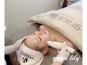 グレイスリリー(grace lily)の写真/韓国最新サーマジ【ピーチリフト】ぽにょっとした口元のたるみ・シワを徹底改善◇速攻小顔を実感！