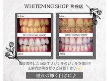ホワイトニングショップ 熊谷店/ 圧倒的効果のオリジナルジェル