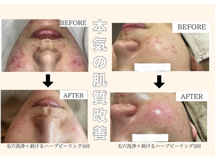 リラックスアンドビューティー ラマナ(la mana)の写真