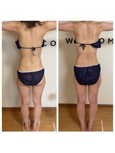 ヨサパーク リアン(YOSA PARK Lien)/モニター様before→after/痩身