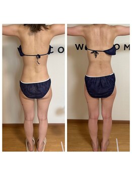 ヨサパーク リアン(YOSA PARK Lien)/モニター様before→after/痩身