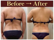 クオレ(CUORE)/ビフォーアフター