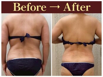 クオレ(CUORE)/ビフォーアフター