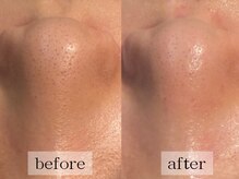 グランビューティ(Glanz Beauty)/20代女性