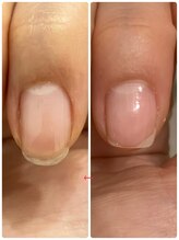 リネイル 長浜(Re-na-iL)/【今だけ】無料相談