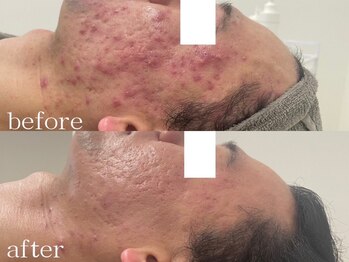 リスト(Rist TOTAL BEAUTY)/2025ニキビ部門全国1位:受賞写真