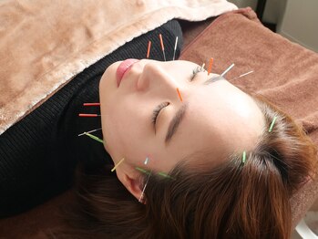 ベルルーナ(Belle-Lune)/美容鍼