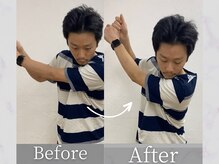 タケダ整体院/ゴルフで肩を痛めた肩の改善事例