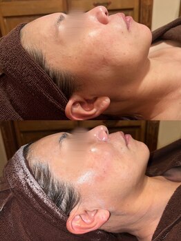 ビューティースタイリング 自由が丘店(beauty styling)/【フォーエバーヤング】