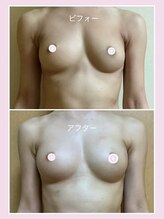 アップオー 小倉店(up・O)/体験者様　施術例