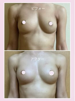 アップオー 小倉店(up・O)/体験者様　施術例