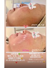 はだなの/ビフォーアフター3ヶ月後