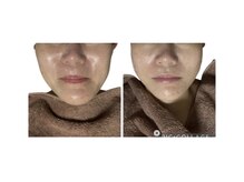 シュクラン(SHUKRAN)の雰囲気（リガメント、スマス筋膜にアプローチ！グロッティープロ×WOTT）