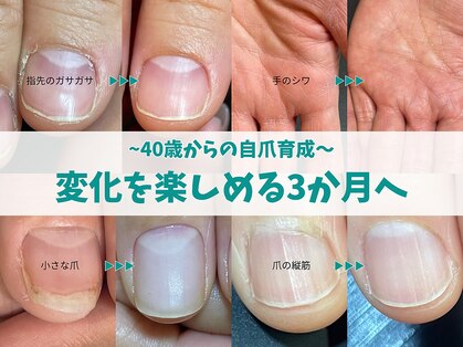 キラリネイル(KIRARINAIL)の写真