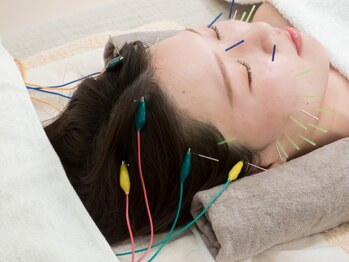 オムリス鍼灸接骨院の写真/美容鍼とハーブピーリングWの施術で大人女性特有のお悩みも解決◎年齢と共に気になるほうれい線ケアにも。
