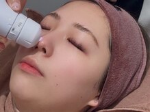 ポアレスラボ 新宿マルイ本館店/気になる毛穴トラブル箇所の撮影