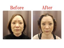 ビューティースリム タニダ/頭蓋骨&小顔&顎関節矯正