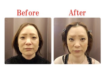 ビューティースリム タニダ/頭蓋骨&小顔&顎関節矯正