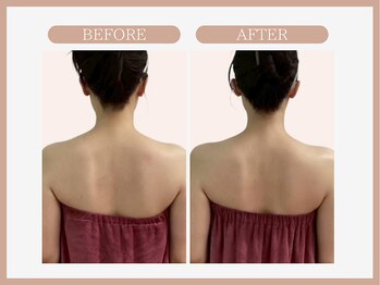 アコガレコガオ 青森店/