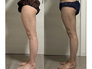 ヨルエステ(yoru aesthe)/【美脚作り】