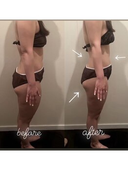 エングロー 錦糸町店(Englow)/【痩身】インド式エステ♪