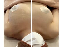 結果にこだわった"美胸ケア"もちふわup♪即実感！感動バストケア