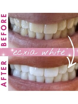 エクシアホワイト 長野店/