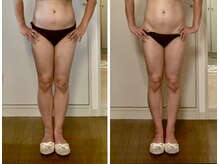 マルデビジュ 西宮(Mar de Bijou)/たった一回の施術結果◎