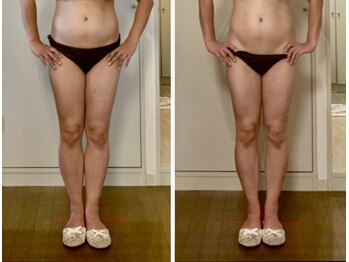 マルデビジュ 西宮(Mar de Bijou)/たった一回の施術結果◎