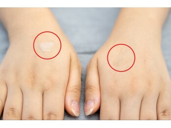 エフ(f)/プラズマで美容液の吸収率をUP