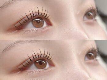 キキ(KIKI)/メーテルロッド