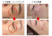 パールプラス 都城店