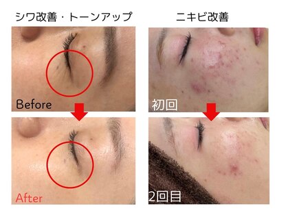 パールプラス 都城店の写真