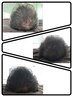 【育毛促進モニター】ヘッドスパ付き 頭皮ダーマ1回あたり ¥13200→¥7260