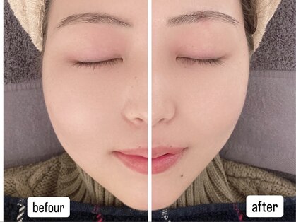 アンドグレイスプラス 恵比寿(&Grace+)の写真