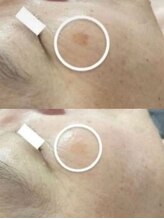 ラエッセ 目黒 白金台店(LAESSE)/毛穴・美白専門店 LAESSE 白金台