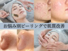 フルール(FLEUR)の雰囲気（話題のクリスティーナ！お悩み別ピーリングで土台から肌質改善☆）