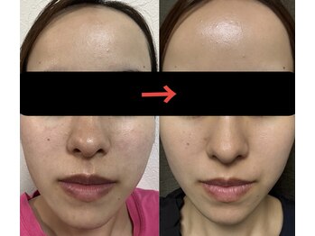 トモニ(TOMONI)/肌質改善サロン　TOMONI