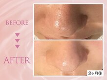 クリアラボ 池袋2nd(Clear Lab)/韓国肌管理&毛穴洗浄専門店