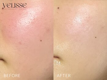 ヴェリス 福岡店(Velisse)/SEN管理症例