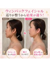エステル 東口本店(esther)
