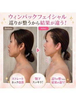 エステル 東口本店(esther)の写真/【結果重視の方必見！】腸×WINBACKフェイシャルでシワ・たるみ改善！ハリ艶のある引き締まった小顔に！