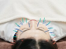 蒼月(aotsuki)/美容鍼