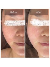 ラビ(RABBI)/40代女性小顔矯正コース