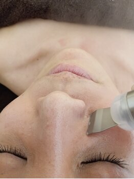 グリーン(green)/毛穴の黒ずみ詰まりゴッソリ